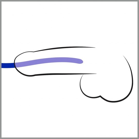 SILIKON DILATOR 3PCS SET
